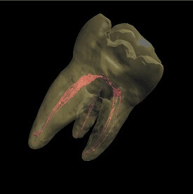 Dentální hygiena Praha - Zubní lékařství Praha 10 - Zubař Praha - Stomatologie Praha - 5 Dentální hygiena Praha - Zubní lékařství Praha 10 - Zubař Praha - Stomatologie Praha - 26