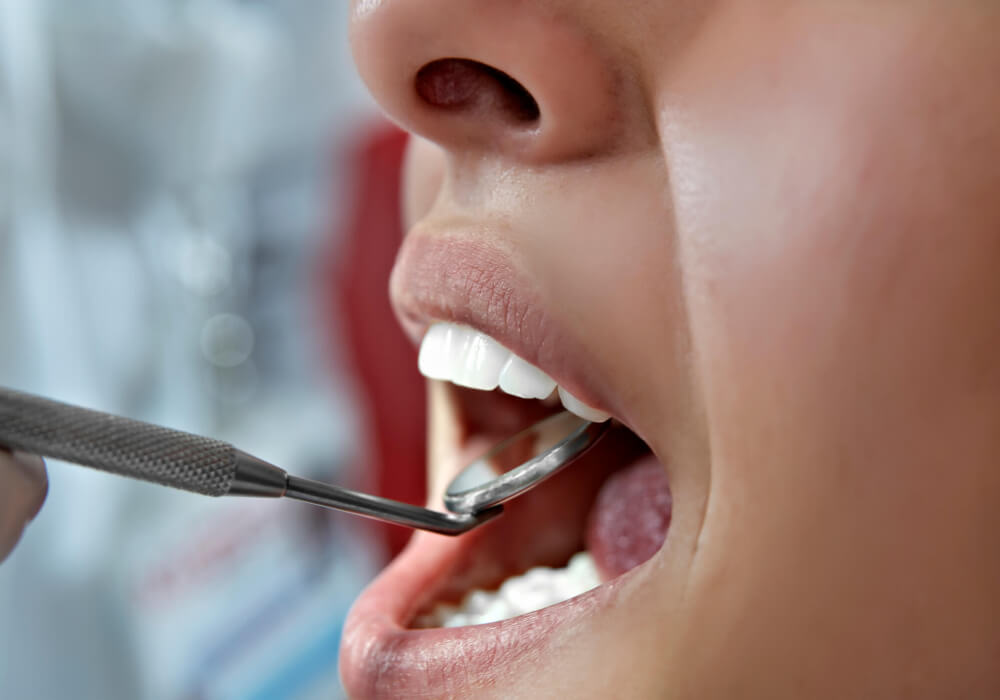 Zánětlivá onemocnění ústní dutiny a hltanu